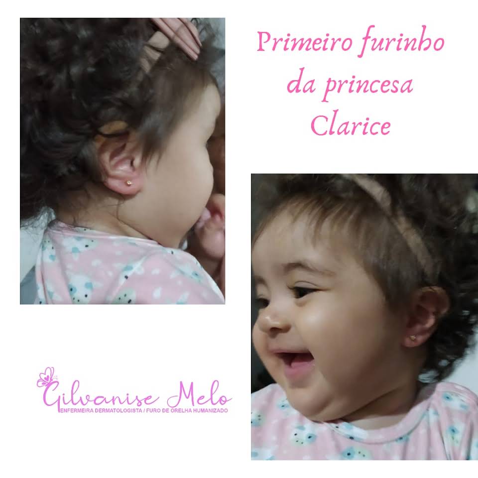 Primeirofurinho-orelha-02